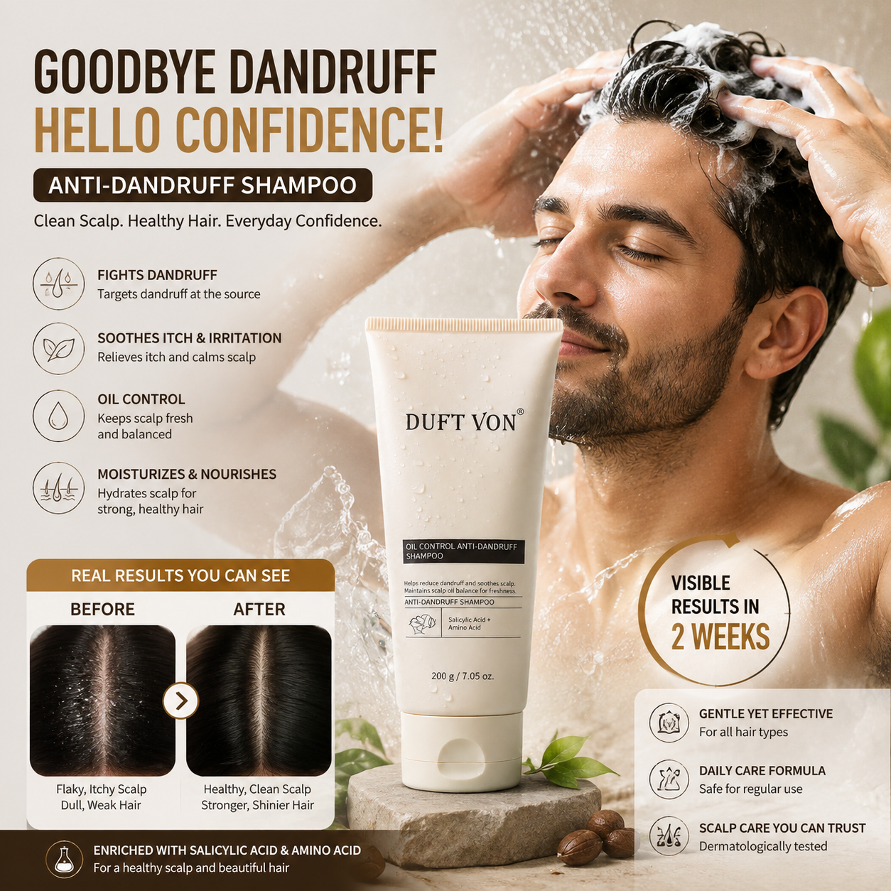 Anti-Dandruff Shampoo Scalp Care Shampoo for Dandruff 200g