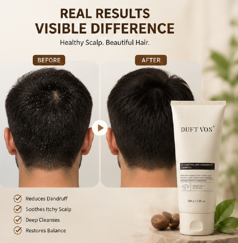 Anti-Dandruff Shampoo Scalp Care Shampoo for Dandruff 200g