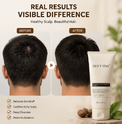 Anti-Dandruff Shampoo Scalp Care Shampoo for Dandruff 200g